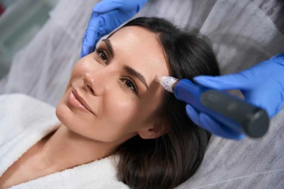 Microneedling in Brooklyn, NY by Glo By Glen Facial Optimization