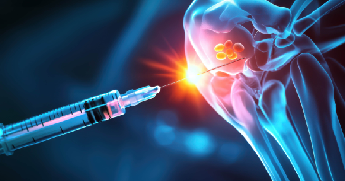 Medical illustration of a syringe injecting stem cells into a knee joint representing Stem Cell Injections in Brooklyn, NY.