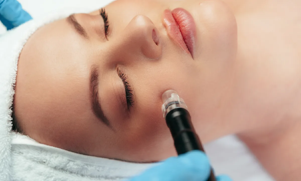 Microneedling treatment for smoother skin texture and fine lines